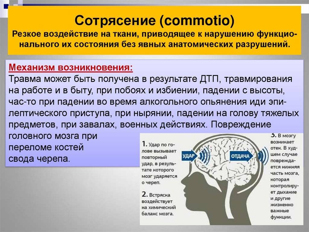 Сотрясение мозга