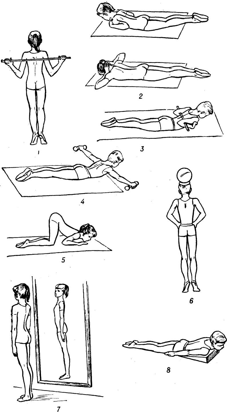 Правильные упражнения при сколиозе, пять правил лечебной физкультуры