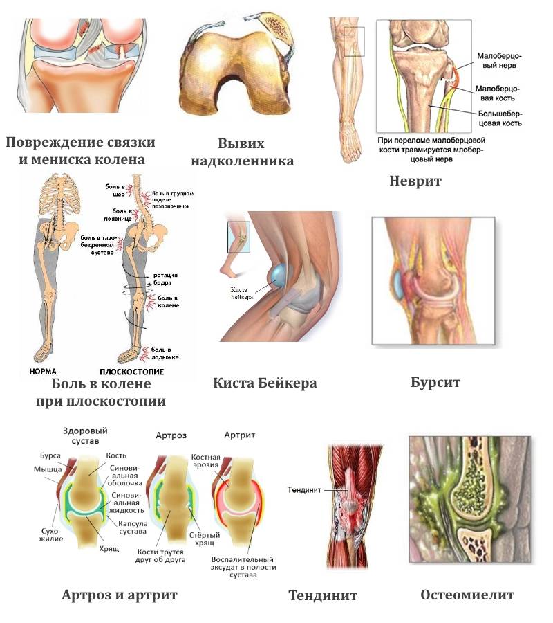 Боли в ногах: причины и лечение, что делать при ноющих болях в но