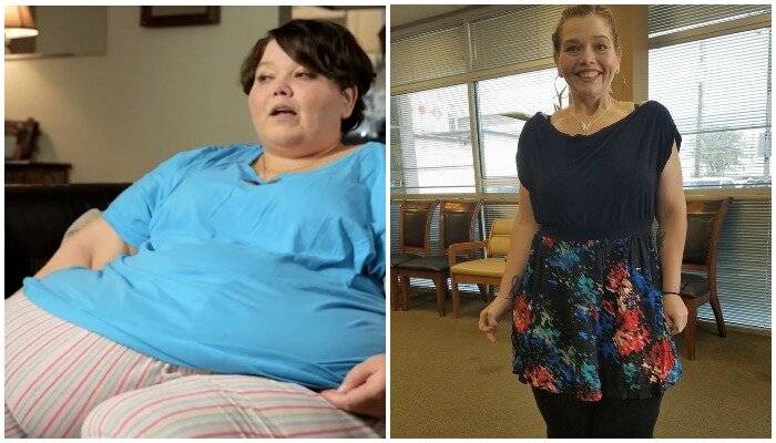 «Я вешу 300 кг: что было дальше» — 5 драматических историй похудения с фото до и после