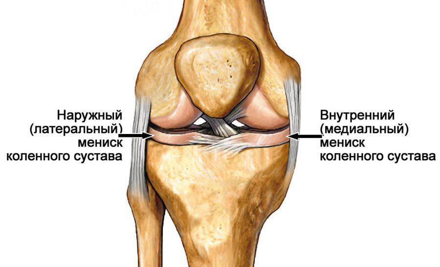 Воспаление мениска коленного сустава | «здравствуй!»