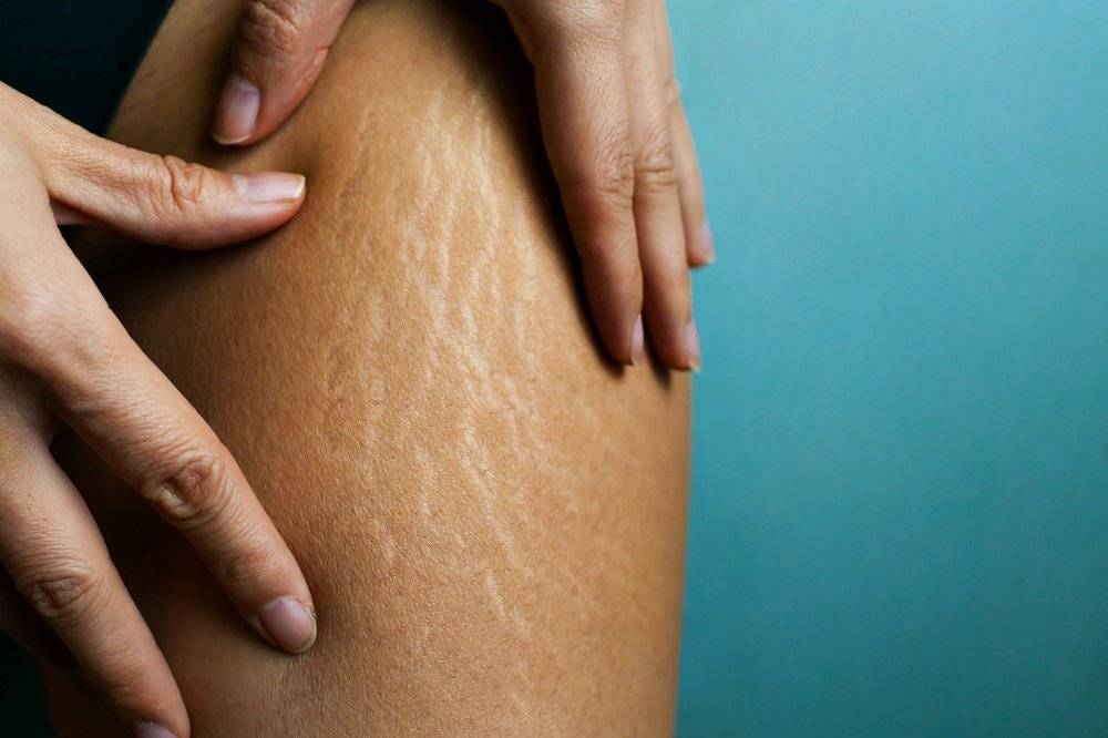 Что делать с дряблой кожей после похудения? ✔️ блог клиники лица