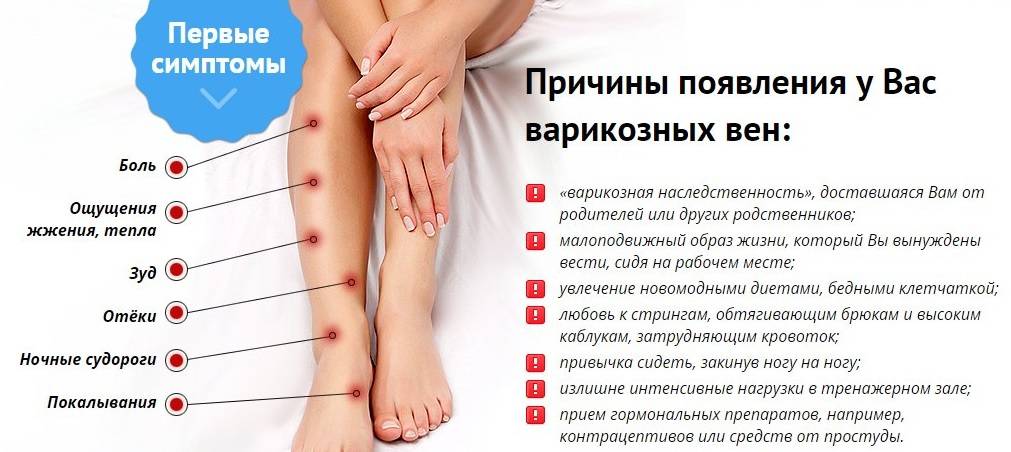 Главные симптомы варикозного расширения вен на ногах