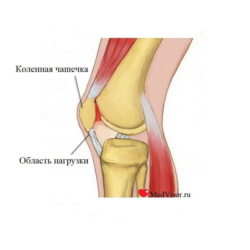 Боли в колене при вставании: причины, лечение в киеве