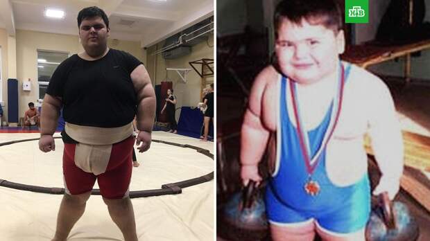Самый толстый человек в мире: вес, история, фото