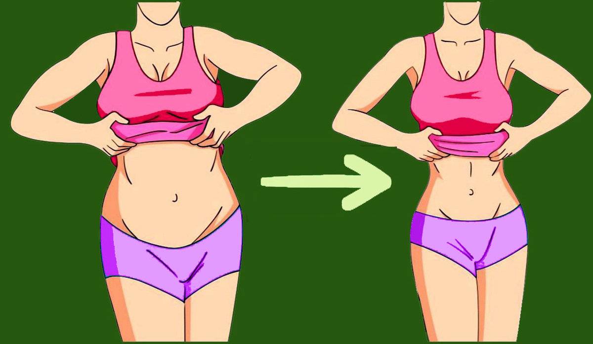 Продольная резекция желудка при ожирении – что нужно знать о прж