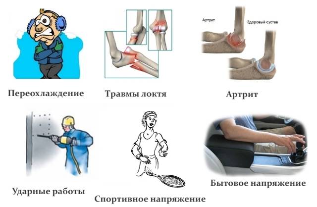Травматология. лечение различных видов травм. травматологи-ортопеды