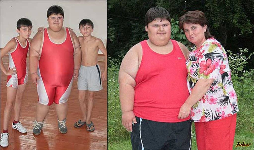 Самый толстый ребенок в мире: как выглядит сегодня мальчик джамбулат хатохов, фото и вес, сколько весит в 2018 году?