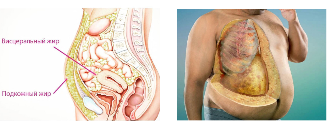 Виды жировой ткани: функции, слои ткани и ген, вызывающий ожирение