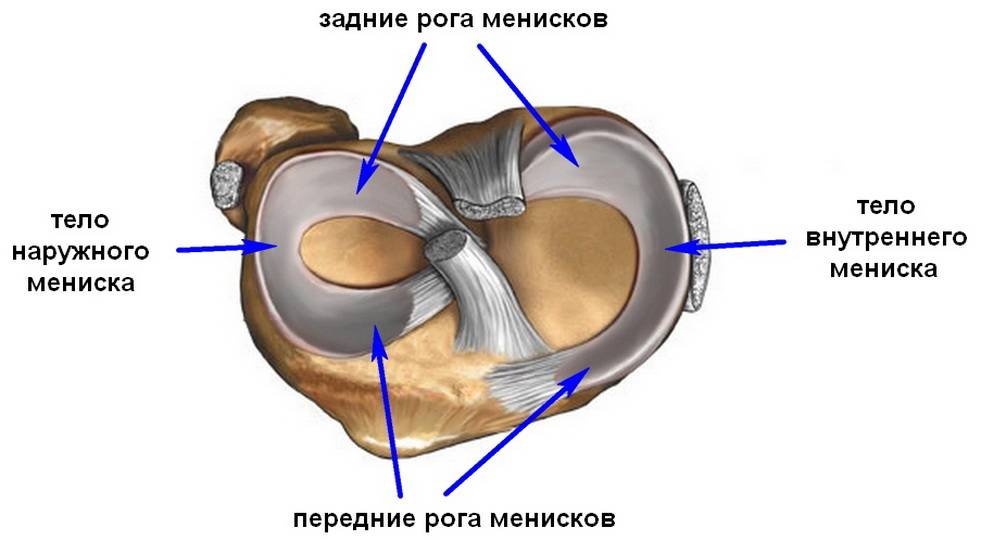 Разрыв мениска коленного сустава. менискэктомия – хирургическое лечение разрыва мениска.