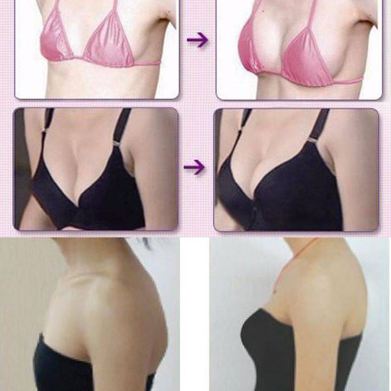 Уменьшение размера грудных желез с помощью операции, диеты и визуально