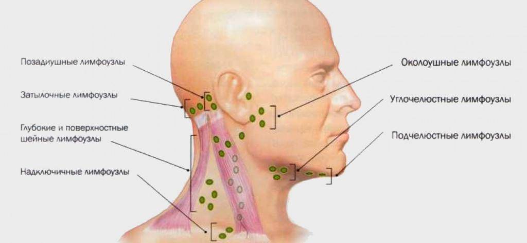 Застужен лимфоузел на шее: как лечить и что делать | клиника «гармония»