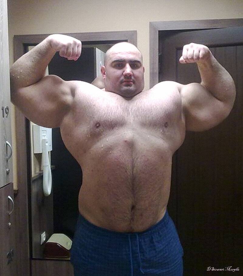 Smas-лифтинг