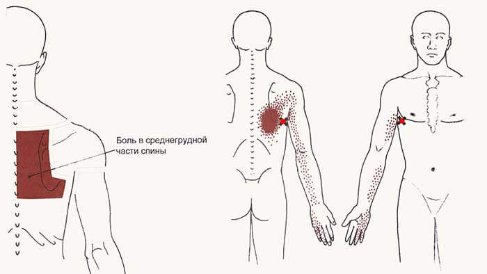 Взаимосвязь между болью в спине и заболеваниями жкт