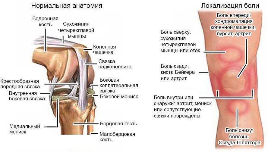 Боли в колене при вставании и приседании, при спуске: причины и лечение в киеве