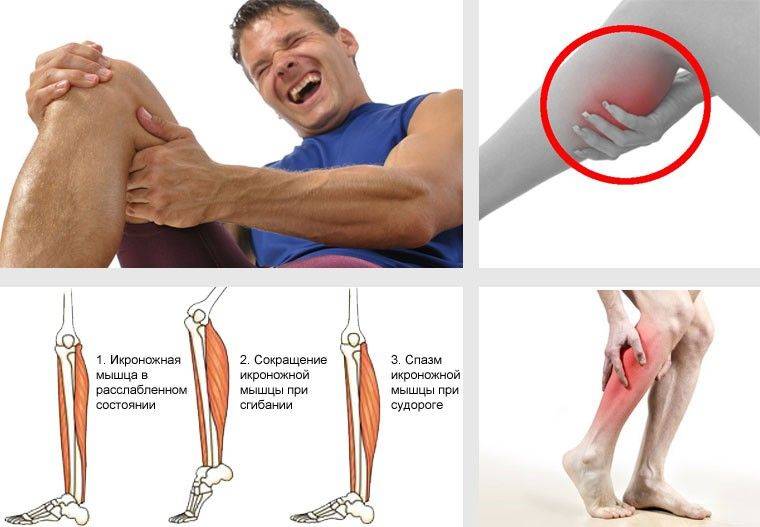 Судороги в ногах: причины и лечение | клиника «гармония»