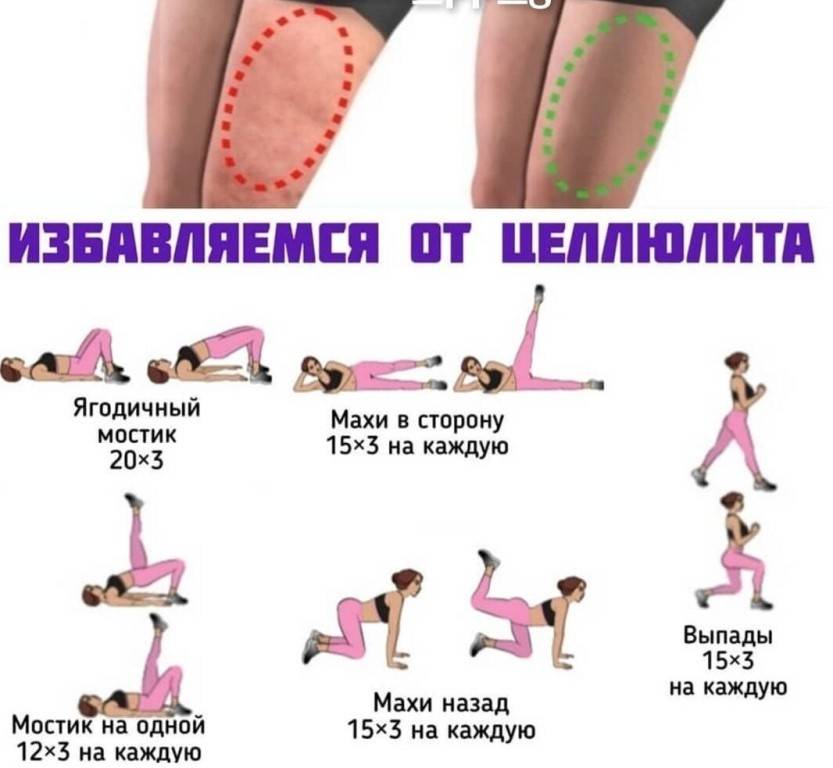 Упражнения от целлюлита на ногах и попе: 2 эффективных комплекса